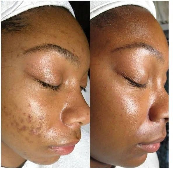 Revive™ Arencia Vitamin C