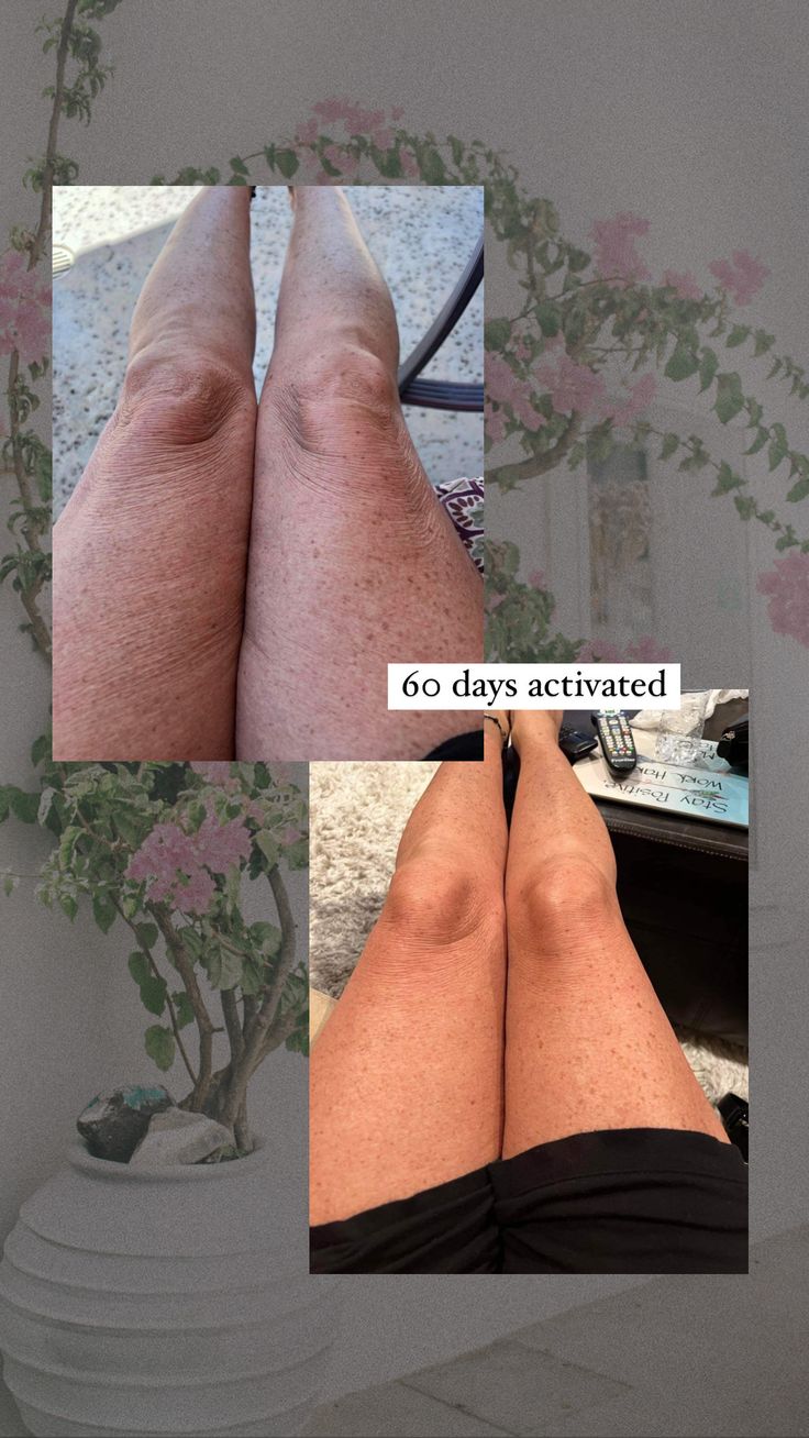 Revive™ Cellulite Smoothing Oil